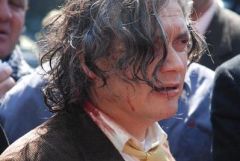 Senator A. Navarro bleeds after a police hit him at the march