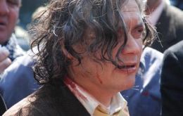 Senator A. Navarro bleeds after a police hit him at the march