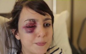 Giuliana Vallone shot in the eye short range with a police rubber bullet 