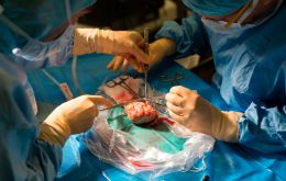 Xenotransplantation would bring on a whole new set of opportunities for patients in need of organs