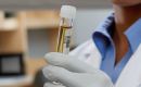 The tests' results will be available around May 10