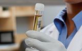 The tests' results will be available around May 10