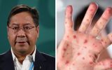 Arce meant that measles spreads faster and wider than Covid-19
