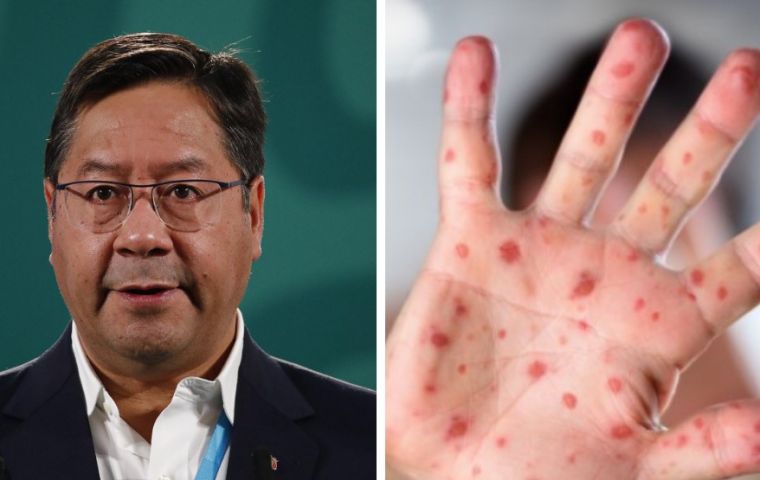 Arce meant that measles spreads faster and wider than Covid-19