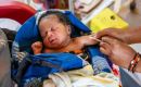 According to the World Health Organization (WHO), in 2024, around 20 million children worldwide were unvaccinated or incompletely vaccinated