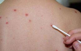 Authorities are focused on vaccination and raising public awareness