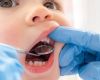The UNICEF survey noted a reduction in households unable to seek dental treatments