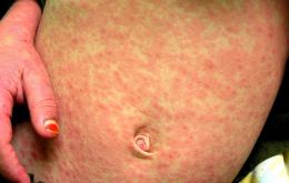 Travelers returning from Europe or the United States must be alert for respiratory symptoms, the Peruvian authorities highlighted