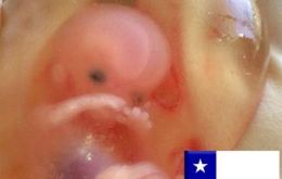 Abortion in Chile is banned under all circumstances 
