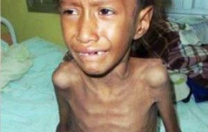 CENM said “it's a similar case to that of Nestor Femenía, the Qom child who died last January, Resistencia of TB. Nestor was also suffering of malnutrition”