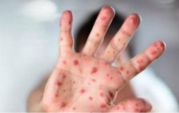 According to the PAHO update, 126 measles cases, including 53 deaths, were reported from the Yanomami communities in Alto Orinoco, state of Amazonas