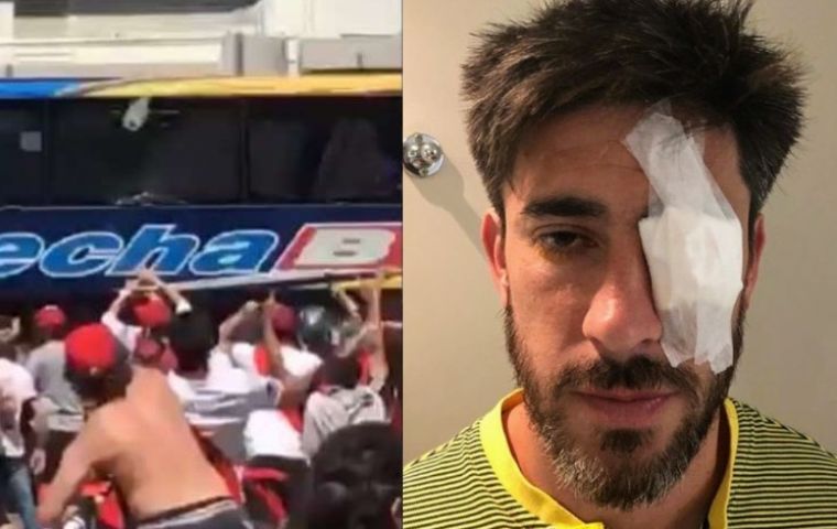 Left: The Boca Juniors bus under attack from hooligans. Right: Boca's Pablo Pérez as he returned to the stadium from the clinic released the picture on social media.