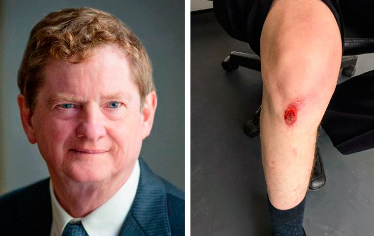 The Toronto-based John Kirton was mugged in Buenos Aires while covering the G-20 Summit and suffered minor injuries. (Photos from Mr. Kirton's Twitter account)