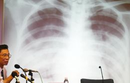 News of the mystery pneumonia outbreak led to speculation that it might be linked to Severe Acute Respiratory Syndrome, a highly contagious respiratory disease