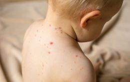 The global total for confirmed measles infections rose to 869,770 last year, the World Health Organization and U.S. Centers for Disease Control said