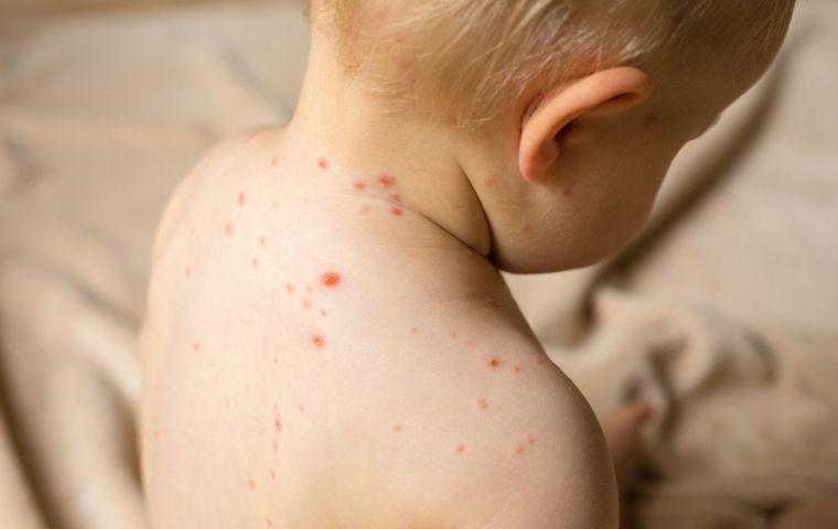 The global total for confirmed measles infections rose to 869,770 last year, the World Health Organization and U.S. Centers for Disease Control said